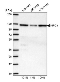 KIFC3 Antibody, Novus Biologicals 25 &mu;L | Buy Online | Novus Biologicals | Fisher Scientific